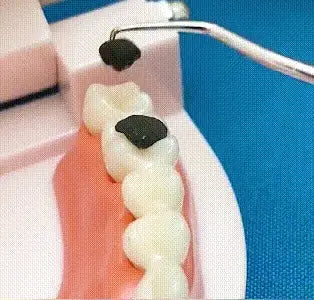 （🔥Kupite 1, dobite 1 gratis🔥）Komplet zobotrebcev iz nerjavečega jekla