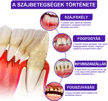 🌟Rolimey® VioCore pasta za zube s pčelinjim otrovom