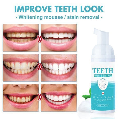 (🔥Kupite enega, dobite enega brezplačno🔥) Več ko kupite, ceneje je.TEETH WHITENING MOUSSE✨