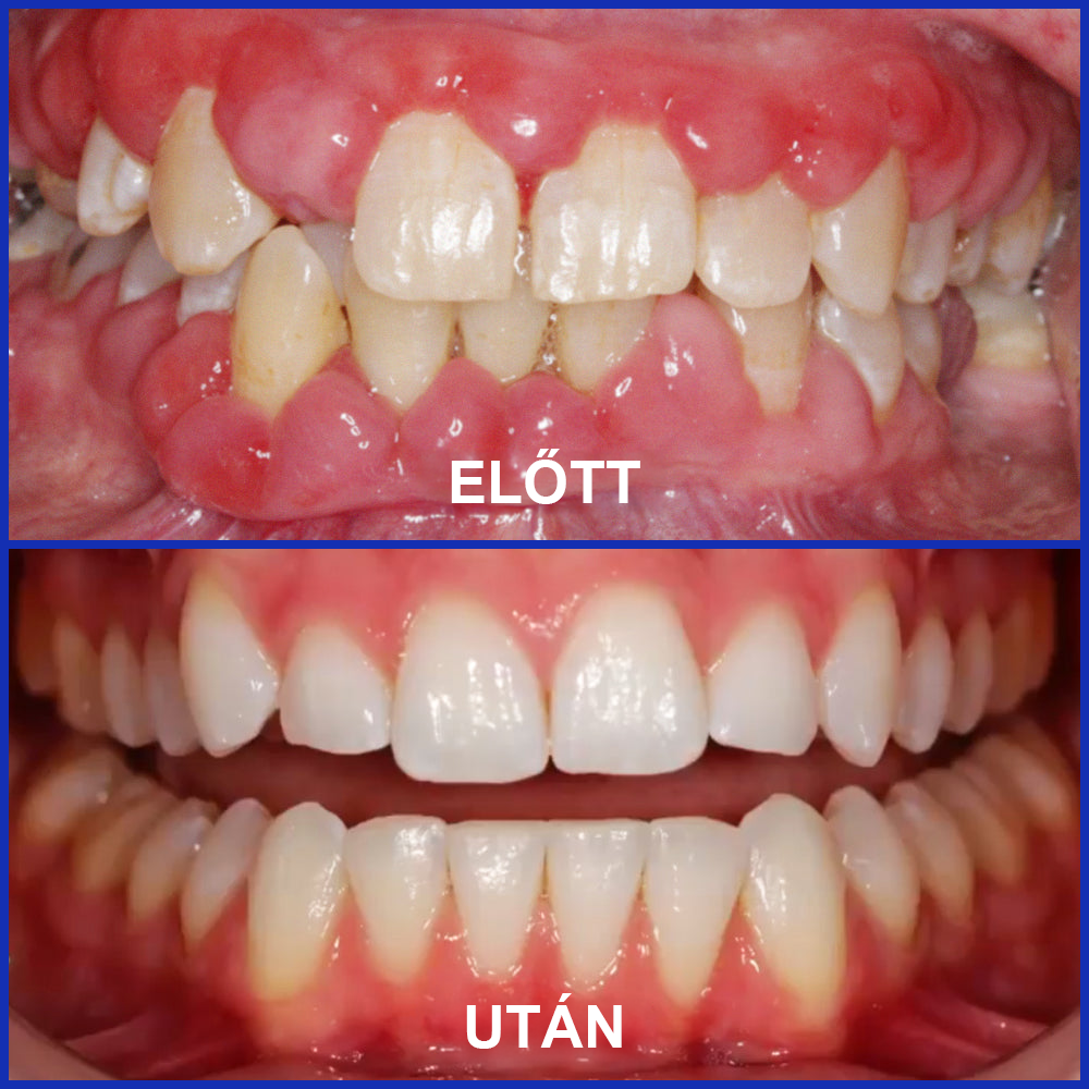 🌟Rolimey® VioCore pasta za zube s pčelinjim otrovom