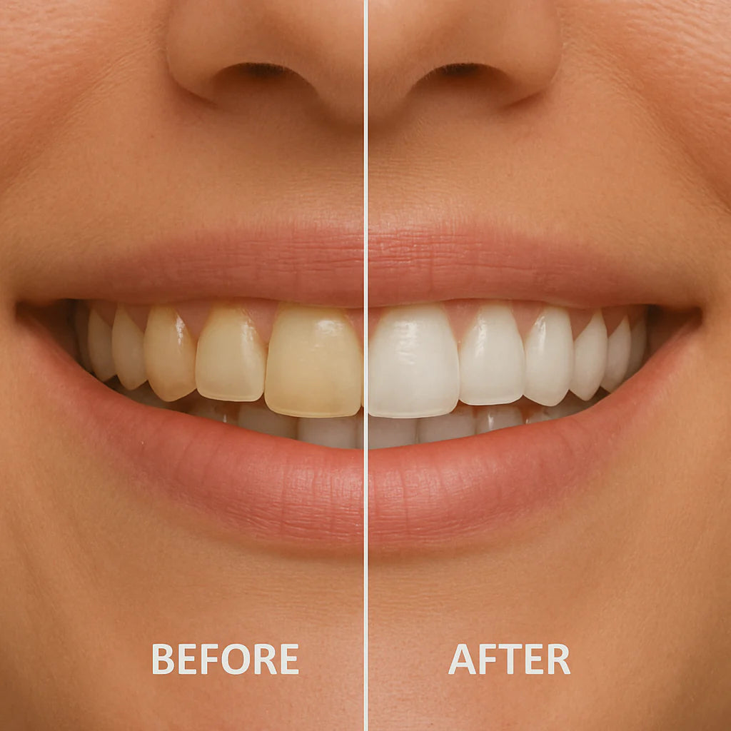 Nano pasta za zube (n-Ha)