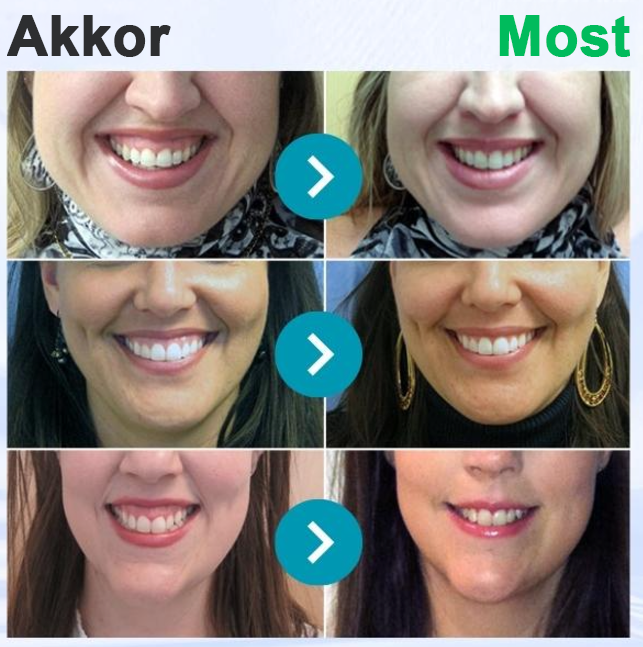 🌟Rolimey® VioCore pasta za zube s pčelinjim otrovom