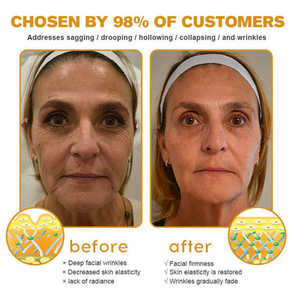 HOOMWELL™Botox Bee Venom Wrinkle Removal Cream